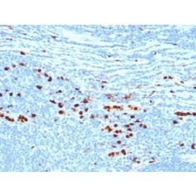 Calgranulin B / MRP-8/-14 / MAC 387 / S100A8/A9 / Macrophage Ag(MAC387), CF488A conjugate, 0.1mg/mL