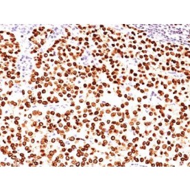 PLGF(PLGF93), CF488A conjugate, 0.1mg/mL