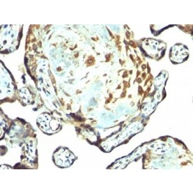TIMP3(Rabbit PAb), CF488A conjugate, 0.1mg/mL