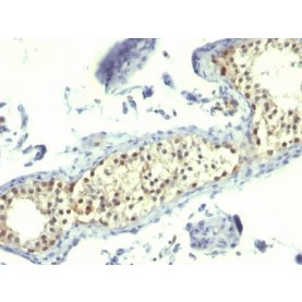 Thymidylate Synthase(TS106), CF488A conjugate, 0.1mg/mL