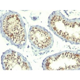 Thymidylate Synthase(TS106 + TMS715), CF488A conjugate, 0.1mg/mL