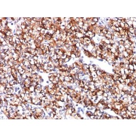 Carbonic Anhydrase IX(CA9/781), CF488A conjugate, 0.1mg/mL