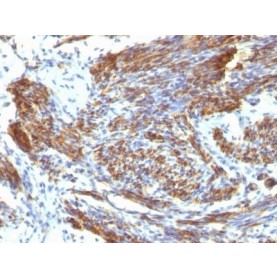Caldesmon, HMW (h-Caldesmon)(CALD1/820), CF488A conjugate, 0.1mg/mL