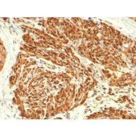 Calponin-1(CALP), CF488A conjugate, 0.1mg/mL