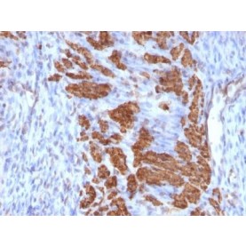 Calponin-1(CALP + CNN1/832), CF488A conjugate, 0.1mg/mL