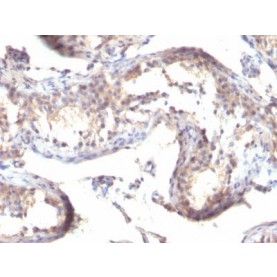 TGFalpha(TGFA/1119), CF488A conjugate, 0.1mg/mL