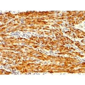 Calponin-1 (Smooth Muscle Marker) (CNN1/1408R), CF488A conjugate, 0.1mg/mL