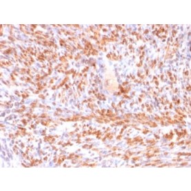 Calponin-1 (Smooth Muscle Marker) (rCNN1/832), CF488A conjugate, 0.1mg/mL