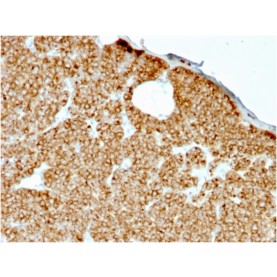 Parathyroid Hormone (PTH) (N-Terminal)(rPTH/911), CF488A conjugate, 0.1mg/mL