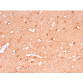 PGP9.5 / UchL1 (pan-Neuronal Marker) (rUCHL1/775), CF488A conjugate, 0.1mg/mL