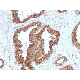PMEPA1 / TMEPAI (Tumor Suppressor Oncoprotein)(PMEPA1/2698), CF488A conjugate, 0.1mg/mL