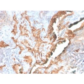 Tenascin C (Stromal Marker For Epithelial Malignancy) (TNC/2981R), CF488A conjugate, 0.1mg/mL