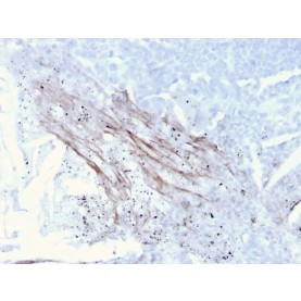 Tenascin C (Stromal Marker for Epithelial Malignancy)(TNC/3635), CF488A conjugate, 0.1mg/mL