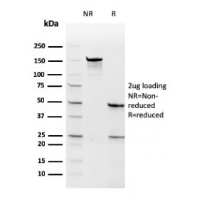 Thymidylate Synthase (5-FU Resistance Marker)(rTYMS/1884), CF488A conjugate, 0.1mg/mL