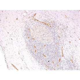 von Willebrand Factor(3E2D10 + VWF635), CF594 conjugate, 0.1mg/mL