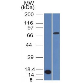 Bcl-6 (Follicular Lymphoma Marker) (BCL6/1475), CF594 conjugate, 0.1mg/mL