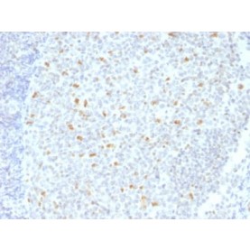 Bcl-6 (Follicular Lymphoma Marker) (BCL6/1526), CF594 conjugate, 0.1mg/mL