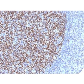 Bcl-6 (Follicular Lymphoma Marker) (BCL6/1527), CF594 conjugate, 0.1mg/mL