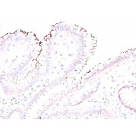 Helicobacter pylori(Rabbit PAb), Biotin conjugate, 0.1mg/mL