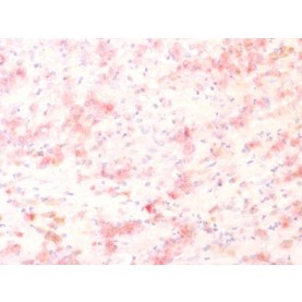 Tyrosinase-Related Protein-1 (TYRP-1) (Melanoma Marker) (TYRP1/1564R), Biotin conjugate, 0.1mg/mL