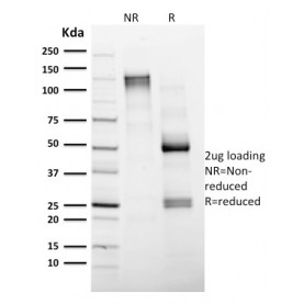 Biotium BNCB1604-100, CD4 (T-Helper/Inducer Cell Marker)(CD4/1604), Biotin conjugate, 0.1mg/mL