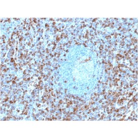 Biotium BNCB1671-100, Annexin A1 / (Hairy Cell Leukemia Marker)(ANXA1/1671), Biotin conjugate, 0.1mg/mL