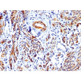 Biotium BNCB1675-100, Caldesmon, HMW (h-Caldesmon) (Smooth Muscle Marker)(), Biotin conjugate, 0.1mg/mL