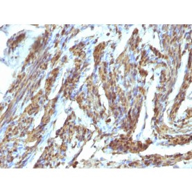Biotium BNCB1685-100, Calponin-1 (Smooth Muscle Marker)(), Biotin conjugate, 0.1mg/mL