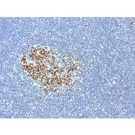 Biotium BNCB1718-100, Bcl-6 (Follicular Lymphoma Marker) (BCL6/1718), Biotin conjugate, 0.1mg/mL