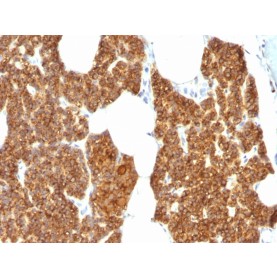 Parathyroid Hormone (PTH) (N-Terminal), Biotin conjugate, 0.1mg/mL