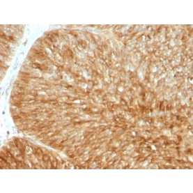 Biotium BNCB1857-100, Beta-2 Microglobulin (Renal Failure & Tumor Marker) (B2M/1857R), Biotin conjugate, 0.1mg/mL