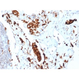 Napsin A (Lung Adenocarcinoma Marker)(NAPSA/1865R), Biotin conjugate, 0.1mg/mL