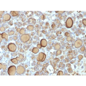 Thyroglobulin (Thyroidal Cell Marker) (TGB/1970R), Biotin conjugate, 0.1mg/mL