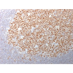 Biotium BNCB1982-100, Bcl-6 (Follicular Lymphoma Marker) (BCL6/1982), Biotin conjugate, 0.1mg/mL