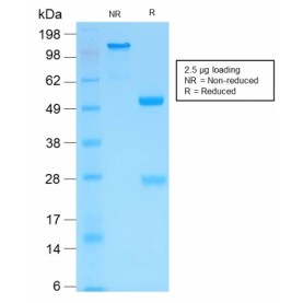 MMP3 (Marker of Metastasis and Rheumatoid Arthritis)(MMP3/1994R), Biotin conjugate, 0.1mg/mL