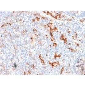 NGF-Receptor (p75) / CD271 (Soft Tissue Tumor Marker) (NGFR/1997R), Biotin conjugate, 0.1mg/mL