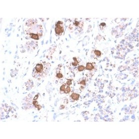 Biotium BNCB2040-500, ACTH (Adrenocorticotrophic Hormone) (Pituitary Marker) (CLIP/2040R), Biotin conjugate, 0.1mg/mL