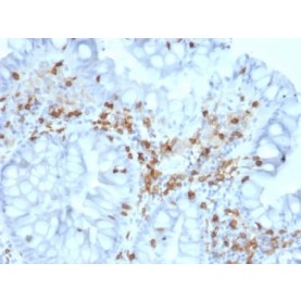 Biotium BNCB2063-100, CD103 / Integrin alpha E (T-Cell Lymphoma & Hairy Cell Leukemia Marker) (ITGAE/2063), Biotin conjugate, 0.1mg/mL