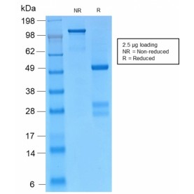 Biotium BNCB2155-100, Catenin, gamma (Cardiomyocyte Marker)(CTNG/2155R), Biotin conjugate, 0.1mg/mL