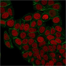 Biotium BNCB2156-100, Catenin, gamma (Cardiomyocyte Marker)(rCTNG/1664), Biotin conjugate, 0.1mg/mL
