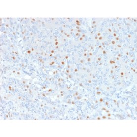 Biotium BNCB2179-500, Annexin A1 / (Hairy Cell Leukemia Marker)(6E4/3), Biotin conjugate, 0.1mg/mL