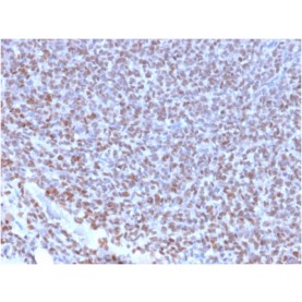 NKX2.2 (Neuroendocrine & Ewing's Sarcoma Marker)(NX2/2198R), Biotin conjugate, 0.1mg/mL