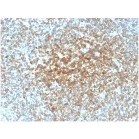 Biotium BNCB2221-100, Bcl-2 (Apoptosis & Follicular Lymphoma Marker) (rBCL2/782), Biotin conjugate, 0.1mg/mL