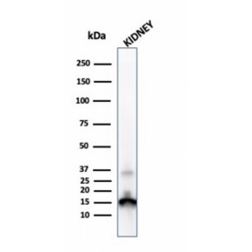 Transthyretin (Prealbumin)(CPTC-TTR-1), Biotin conjugate, 0.1mg/mL