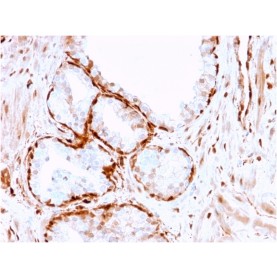 Biotium BNCB2256-100, Aldo-keto Reductase Family 1 Member B1 (Adrenal Marker)(CPTC-AKR1B1-3), Biotin conjugate, 0.1mg/mL