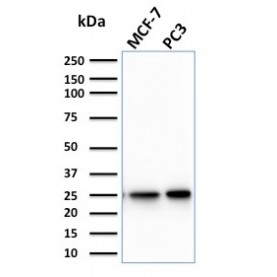 Biotium BNCB2266-100, Calcineurin B homologous protein 2 / HCC Antigen 520(CPTC-CHP2-1), Biotin conjugate, 0.1mg/mL