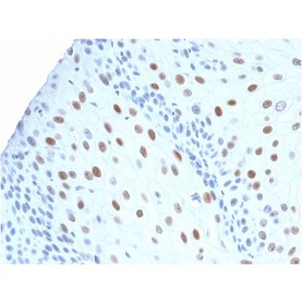 p21WAF1 (Tumor Suppressor Protein)(CIP1/2275R), Biotin conjugate, 0.1mg/mL