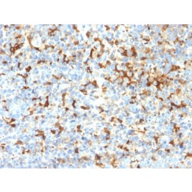 Tyrosinase-Related Protein-1 (TYRP-1) (Melanoma Marker) (TYRP1/2340R), Biotin conjugate, 0.1mg/mL