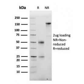 Biotium BNCB2355-100, Albumin (Transport Protein)(ALB/2355), Biotin conjugate, 0.1mg/mL