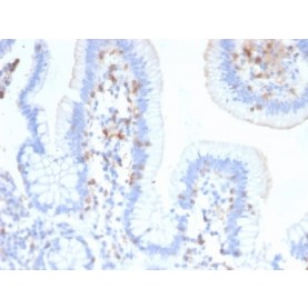 Biotium BNCB2474-100, CD103 / Integrin alpha E (T-Cell Lymphoma & Hairy Cell Leukemia Marker) (ITGAE/2474), Biotin conjugate, 0.1mg/mL